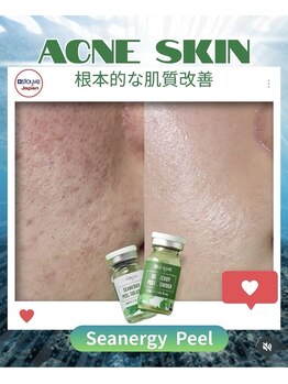 クロシェット(Clochette)/