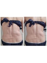 ルクソール/レモンボトル(痩身)