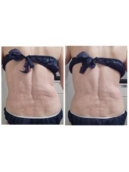 ルクソール/レモンボトル(痩身)