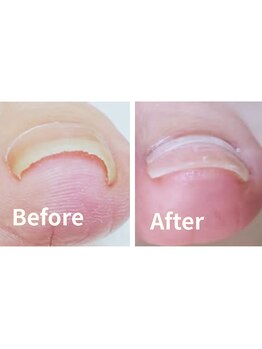 リゼラアンドコー 相模大野店/ドイツ式フットケア専門店