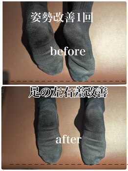 リバイブ 自由が丘店(REVIVE)/姿勢改善1回