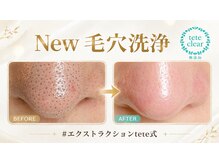 サロンド ケイティ(Salon de Katy)の雰囲気（今話題！の毛穴エクストラクション/毛穴洗浄/毛穴ケア/毛穴）