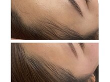 モワメーム(moi meme)/フェイシャルワックス3回分