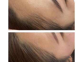 モワメーム(moi meme)/フェイシャルワックス3回分