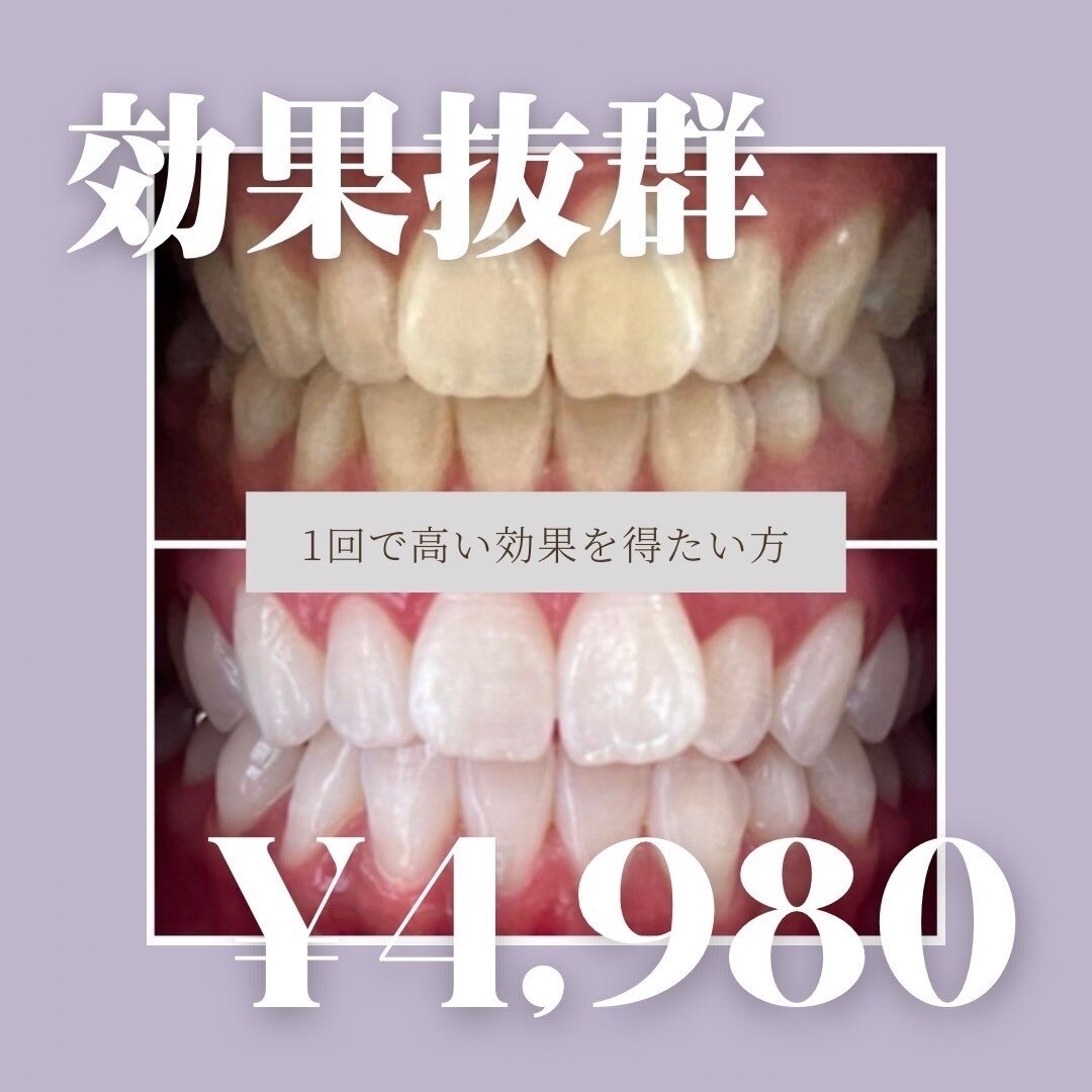 【ロング照射で効果実感】1回で高い効果を得たい方！45分照射　\4,980