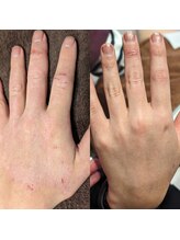 トリニティスペース(TrinitySpace)/全身できる！プラズマボディ★