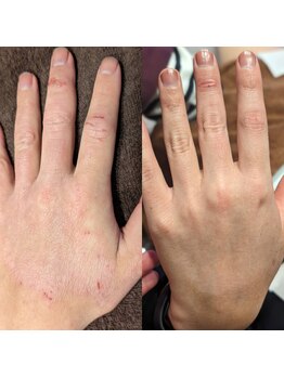 トリニティスペース(TrinitySpace)/全身できる!プラズマボディ★