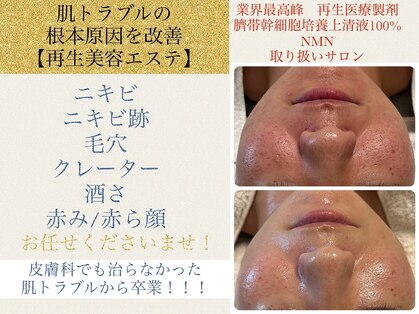 サロン ド エメ(salon de aimer)の写真