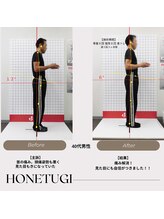 ほねつぎ総社 はりきゅう接骨院/成果/首の痛み・頭痛