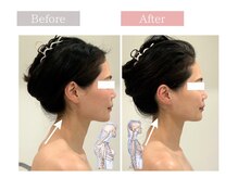 フロリール アザブジュウバン(FlorirAzabujuban)の雰囲気（首の角度で顔の重力（たるみ）を加速させます《小顔矯正》）