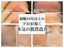 ノア 新宿(Noa)