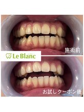ルブラン 奈良店(Le Blanc)/初回クーポンで効果を実感♪
