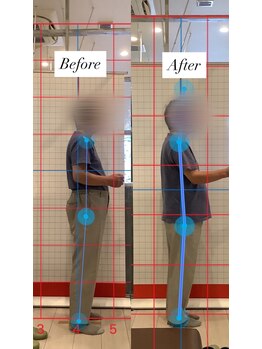 もにわ接骨院/腰痛改善