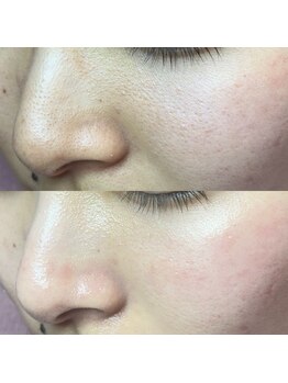 エミュ(emu)/ハーブで肌育