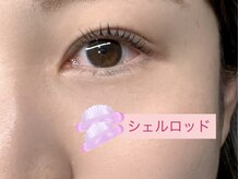 シュピネ(Choupinet)/◯短くても上がります◯