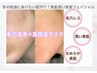 【毛穴つまり・黒ずみ・ざらつき改善＆乾燥対策】毛穴洗浄×高保湿マスク