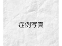 イーズ/リバイタ 梅田本店/