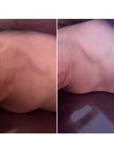 コルッソ(CoLusson.)/首肩凝りスッキリ！首も長く！