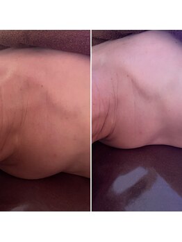 コルッソ(CoLusson.)/首肩凝りスッキリ!首も長く!