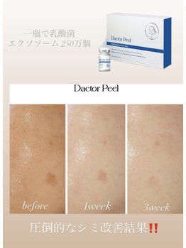 シュシュ(chouchou)/ダクトピール / シミ改善