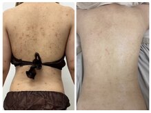 都度払いサロン Clear＋ 泡瀬店【クリアプラス】脱毛/フェイシャル/痩身/バストケア/肌管理メニュー