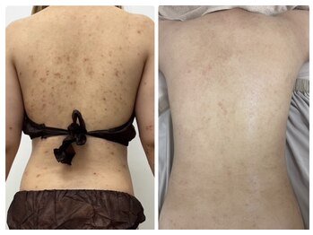 都度払いサロン Clear+ 泡瀬店【クリアプラス】脱毛/フェイシャル/痩身/バストケア/肌管理メニュー