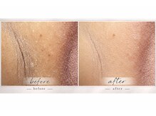 ビオエル(BIOELU)の雰囲気（１回でも変化を実感。「見せたくない」から「触れたくなる」肌へ）