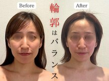 エレミュー 烏丸(Elemue.)