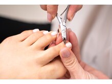 グリーンティファニー 麻布十番(Green Tiffany)/プロの巻き爪ケア