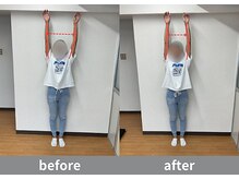 アオ整体院/左肩の痛みと可動域が改善