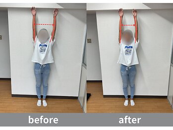 アオ整体院/左肩の痛みと可動域が改善
