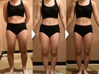 マイン 幸店/マイン集中痩身