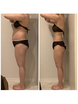 エステサロン ブレス 山形店(BLESS)/セルゼロ痩身