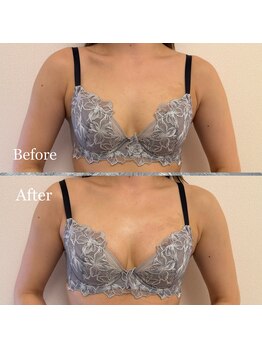 プリマベラ 大阪梅田(primabella)/ブラから逃げないバスト作り！