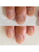 シーネイル(C Nail)/育成ケアたった1回でキレイに