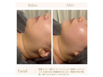 パーソナル ユニ(uni)の写真