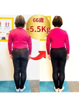 アロエ(Aloe)/ビフォーアフター　　60代