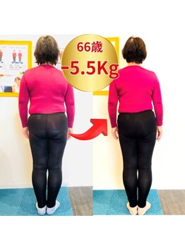 アロエ(Aloe)/ビフォーアフター　　60代