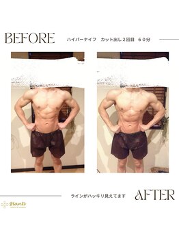 グランツ 小山店/カットだしのお客様　施術2回目