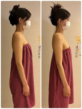 ロココ 豊田店(Rococo)/ビフォーアフター