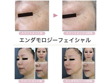 ビノス(Binosu)の写真