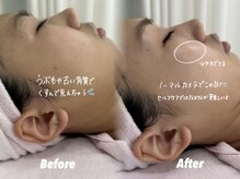 クイーン 渋谷店(QUEEN)/剃るだけでツヤ肌