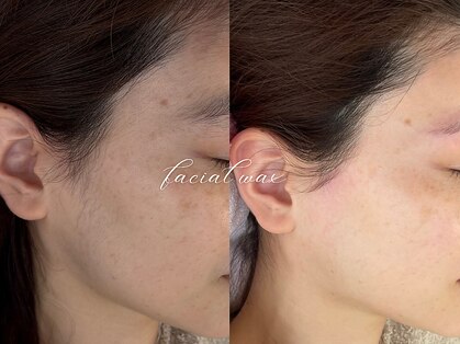 ボーテラボ 大宮(beaute LABO)の写真