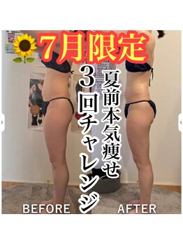 ベルフルール 浜松中野町店の写真/「痩身は痛い・怖い」を覆す、感動のセルゼロ体験