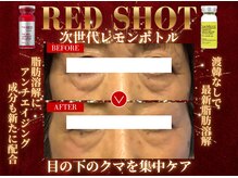 モテ美白