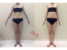 チャーム(Charm)/