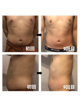 伊達男/フォースカッター 事例