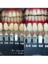 トウキョウスワーズ 池袋店(TOKYO SWRS)/#ホワイトニング #池袋 #渋谷