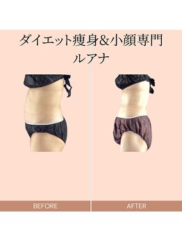 ルアナ(Luana.)/ダイエット痩身&小顔専門-ルアナ