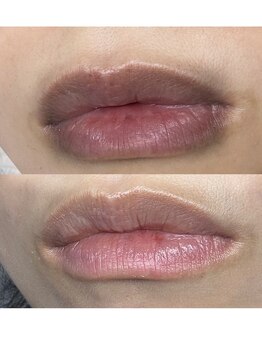 エクスクラメーションマーク(!!!)/メラニンケア